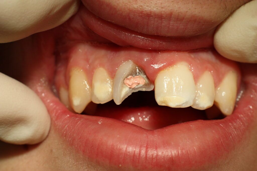 Dental Procedures